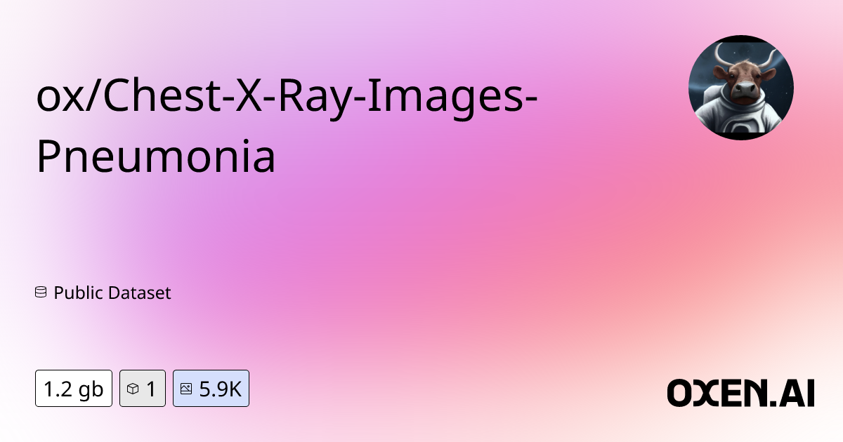 ox/ChestXRayImagesPneumonia Datasets at Oxen.ai